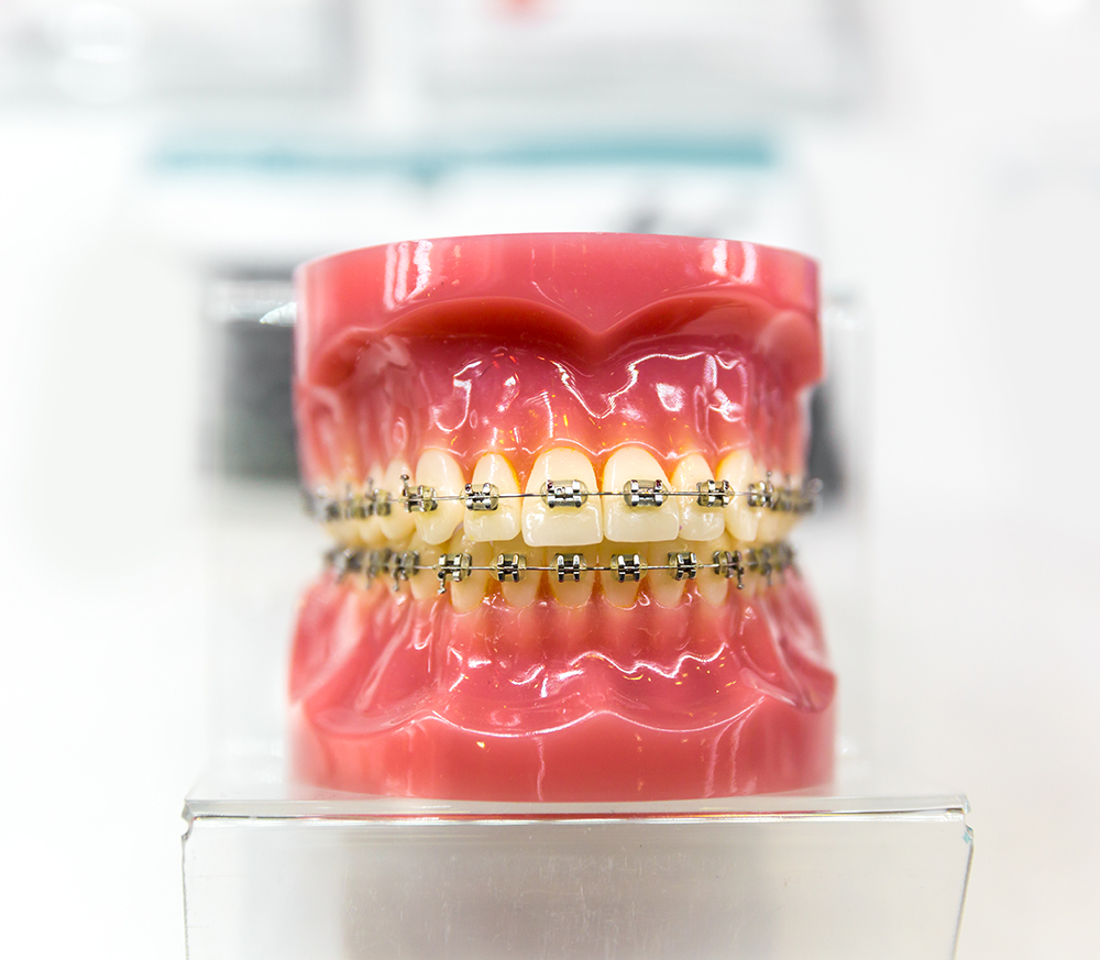 Prodent_Stomatologia_Dentysta_Gdansk_dental-equipment-orthodontic-denture-closeup-PANV8CQ