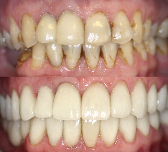 Prodent_Stomatologia_Dentysta_Gdansk_Prodent_metamorfoza1