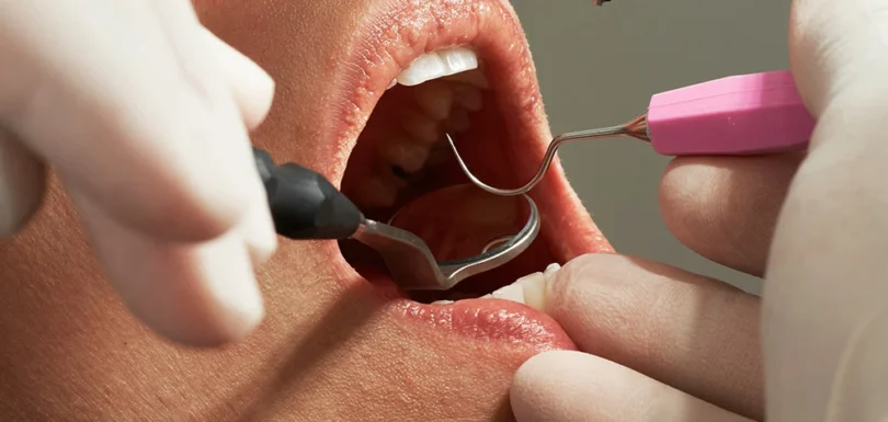 Chirurgia stomatologiczna Gdańsk w klinice Prodent – nowoczesne leczenie chirurgiczne zębów