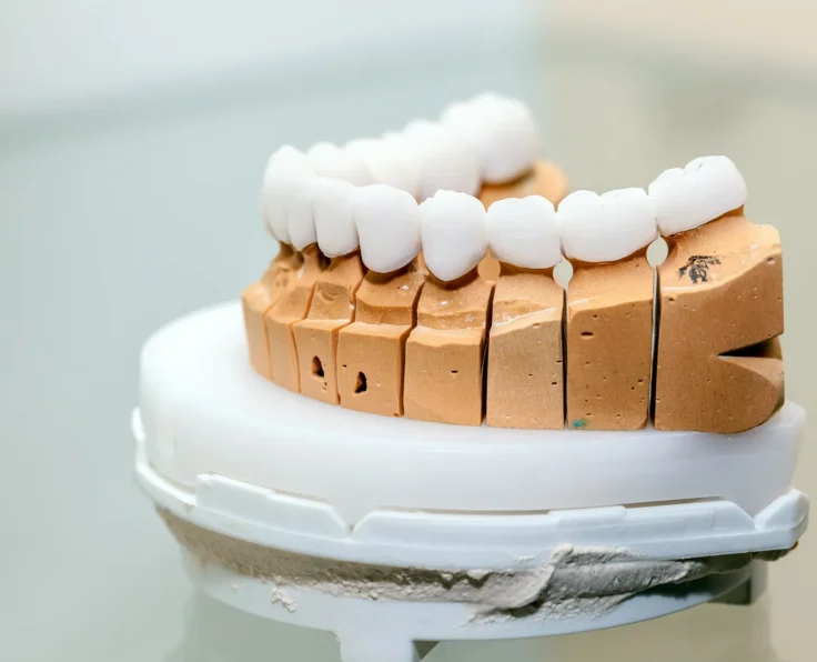 IMPLANTO PROTETYKA GDANSK DENTYSTA