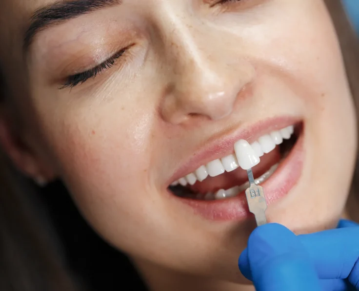 Zabiegi stomatologii estetycznej 3