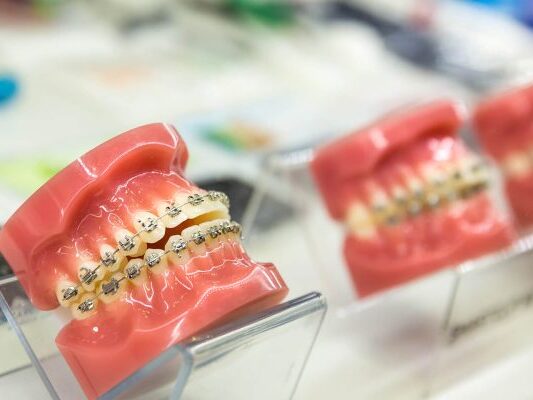 leczenie ortodontyczne