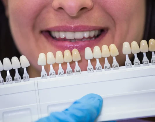 licówki zakładanie dentysta gdansk