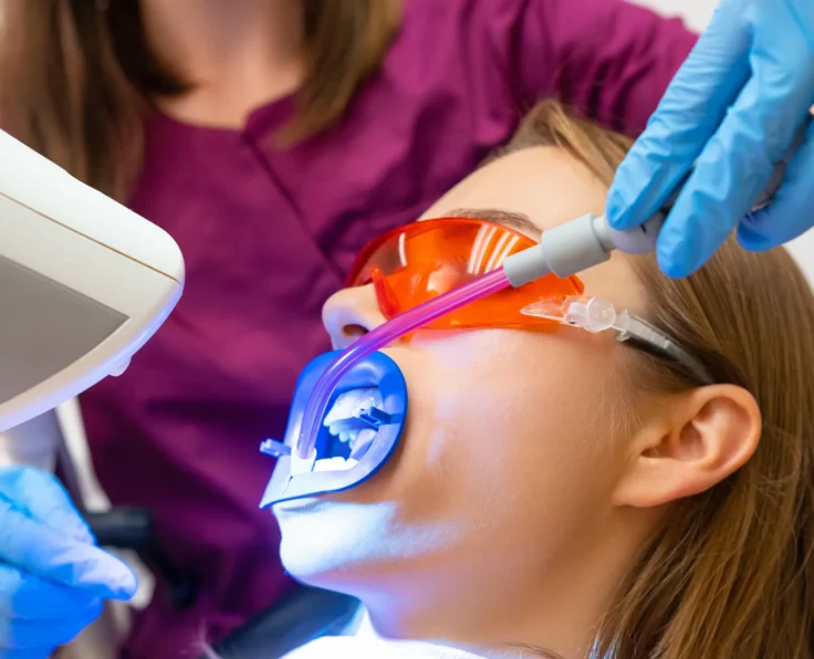 wybielanie zębów w gdańsku