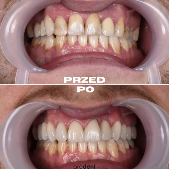 metamorfoza 10 prodent