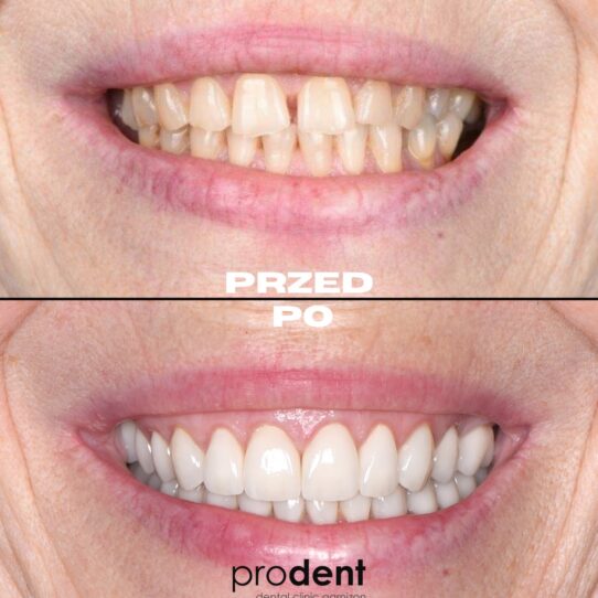 metamorfoza 8 prodent