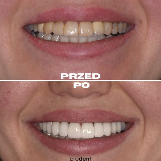 metanorfoza 9 prodent