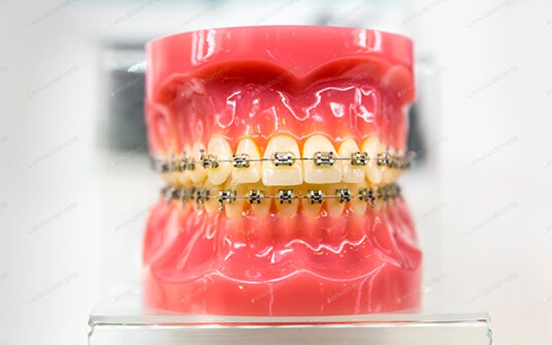 Ortodonta Gdańsk - leczenie wad zgryzu, czy warto?